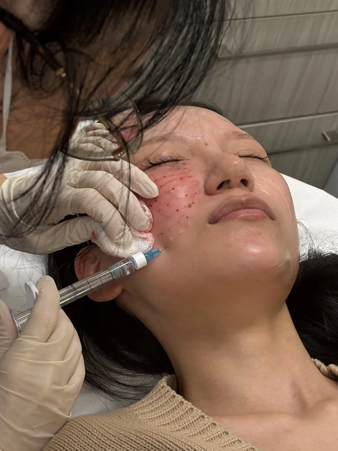 Facial injectable treatment performed by a clinician at HEMAC